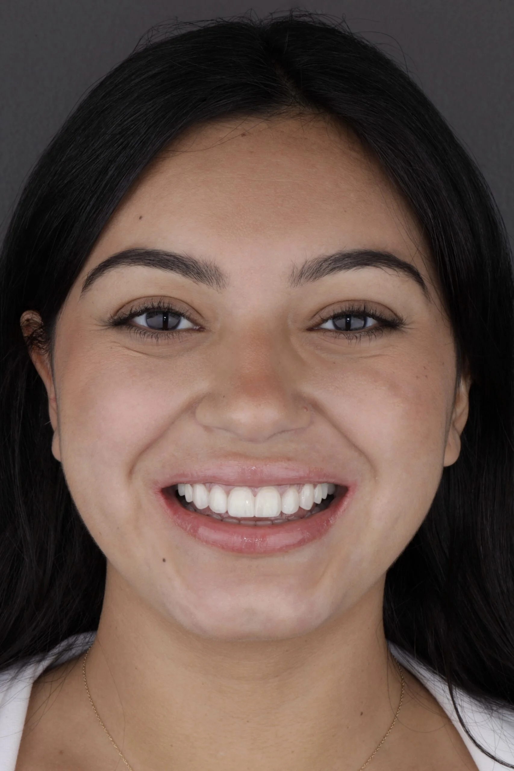 Beyond Aesthetics: Nicole’s dental path