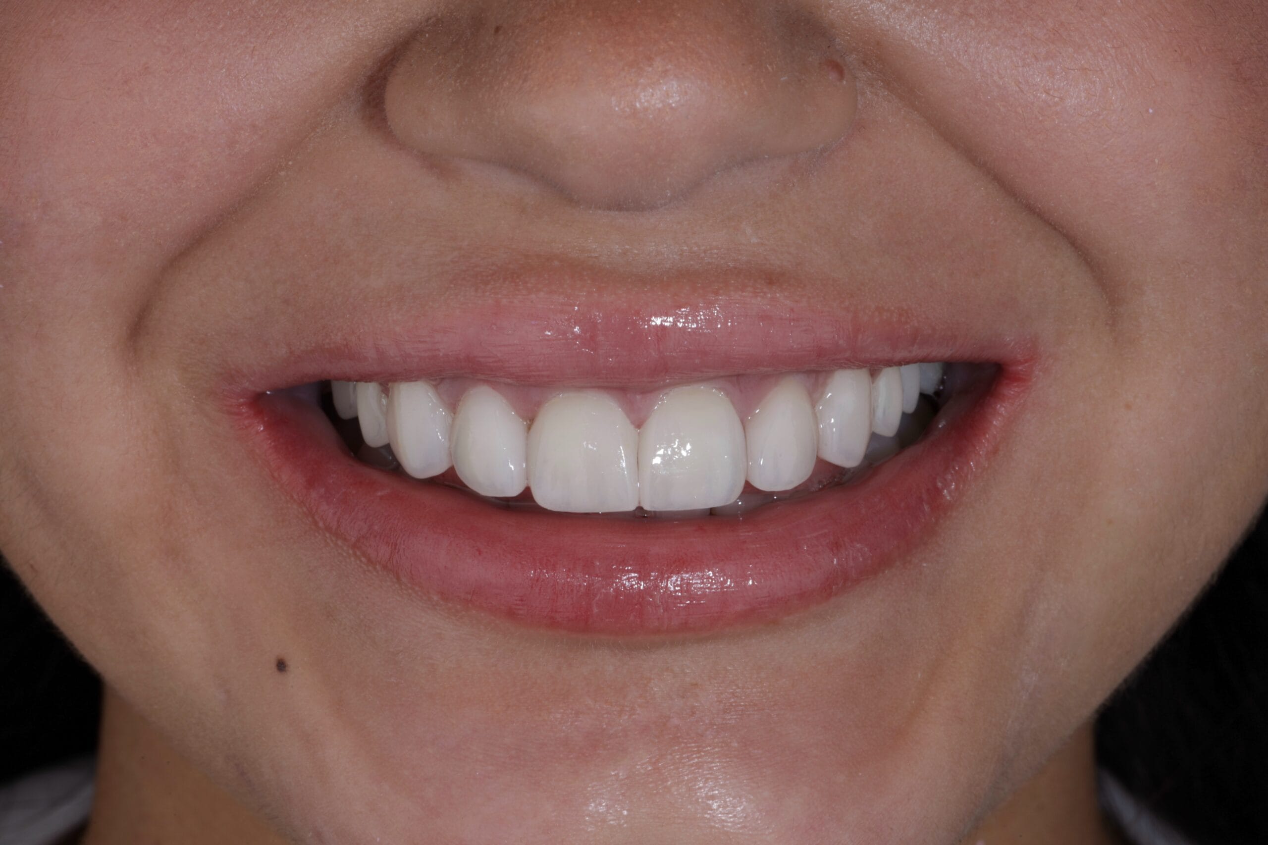 Beyond Aesthetics: Nicole’s dental path