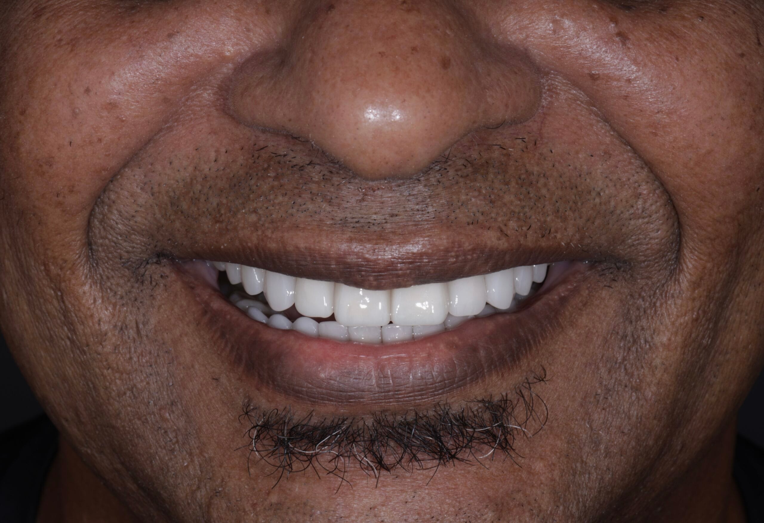 Say no more to dental gaps:                                    Clifton’s journey to a perfect smile.