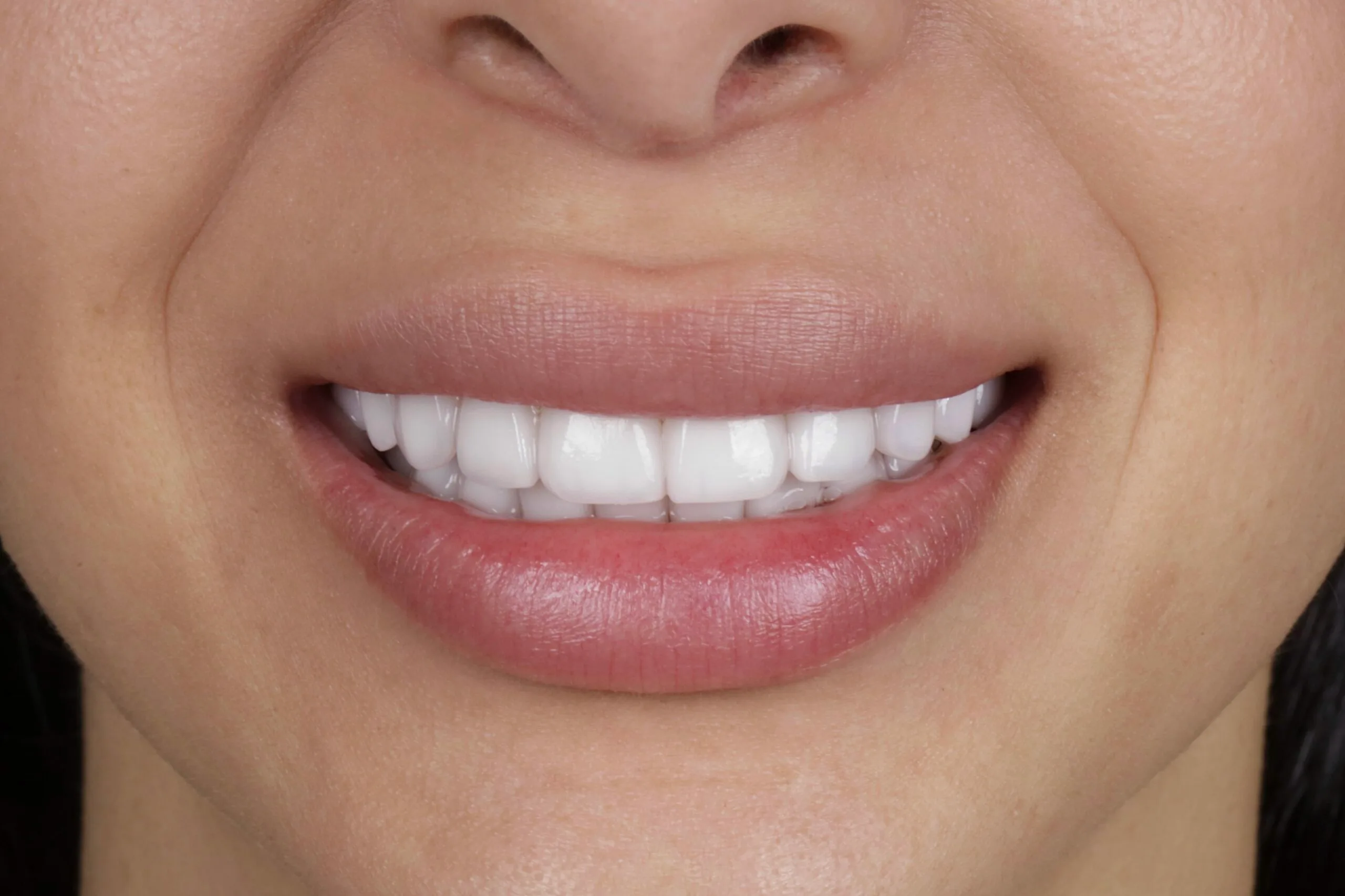 From Barranquilla to Hollywood: Stephanie and her new smile