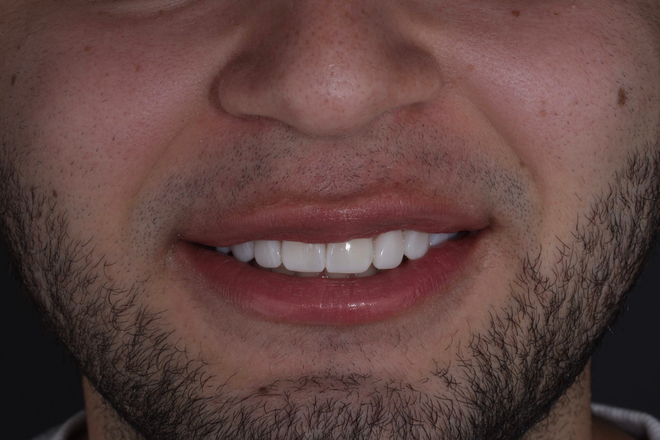 The detail that changes everything: Jose´s smile boost.