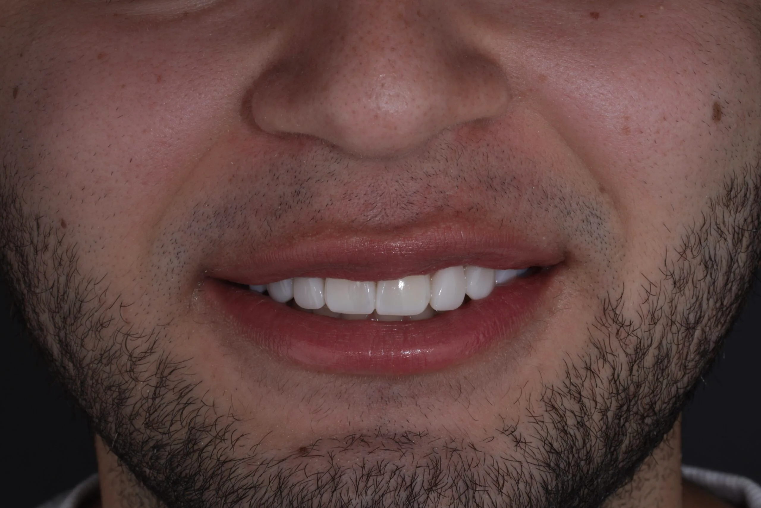 The detail that changes everything: Jose´s smile boost.