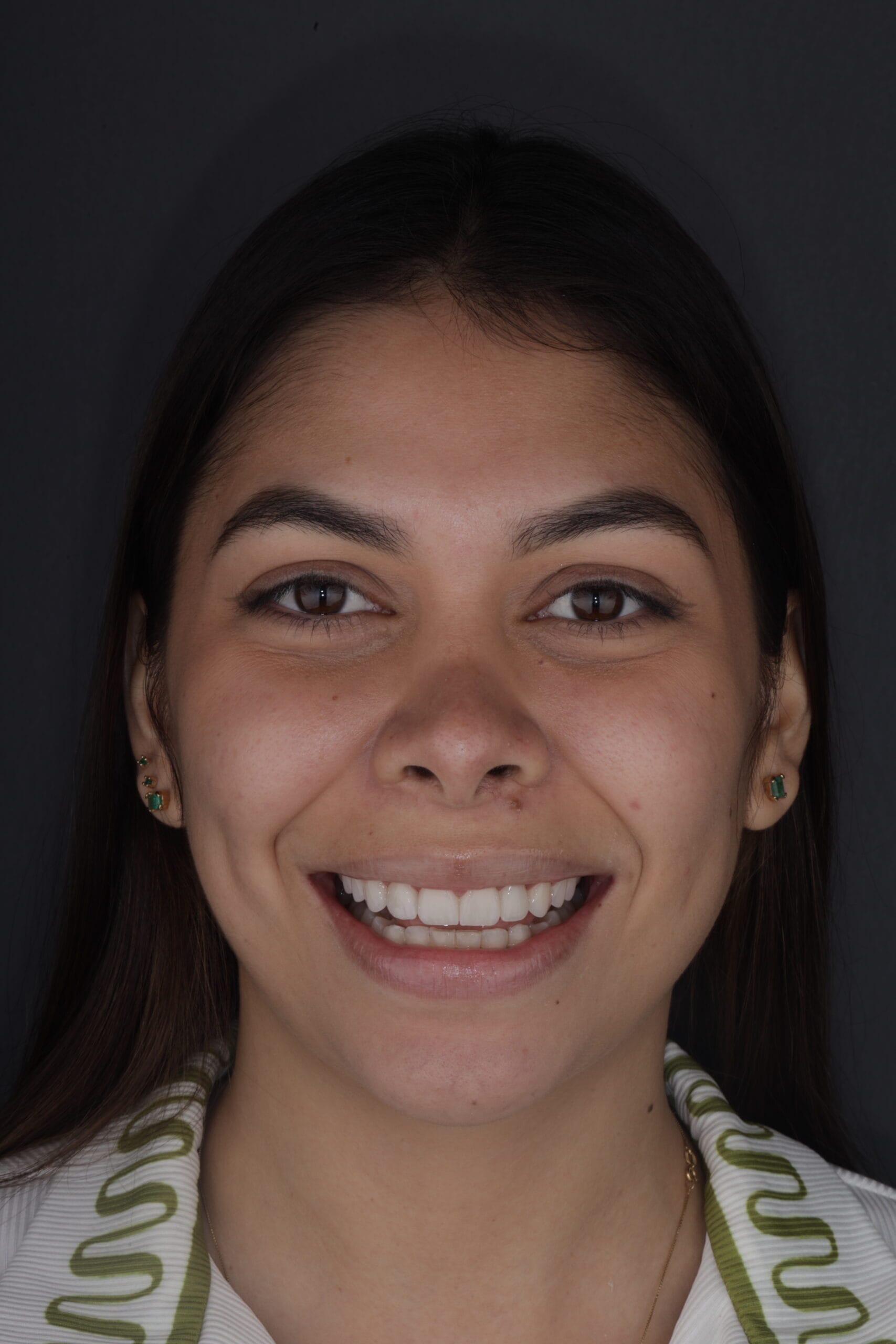 The Art of Blending: Ivana’s renewed smile.