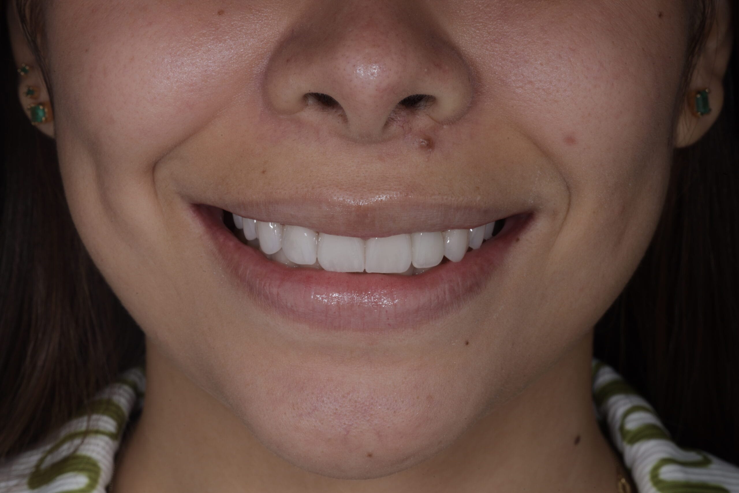 The Art of Blending: Ivana’s renewed smile.