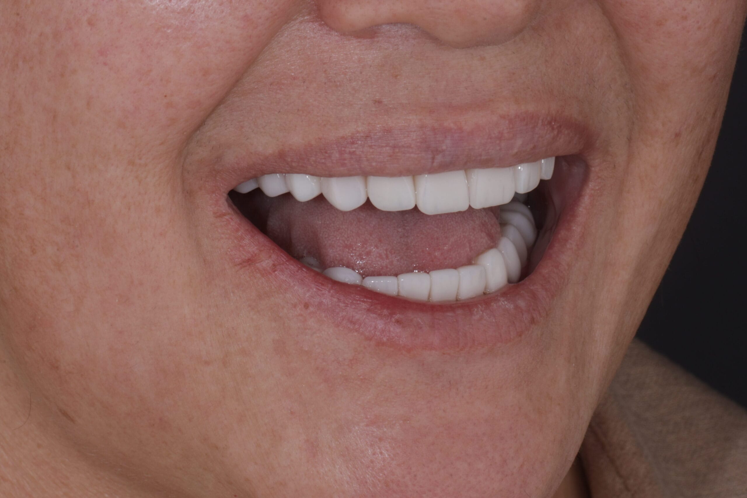 cosmetic dentist Barranquilla Dr. Daniel Zabaleta