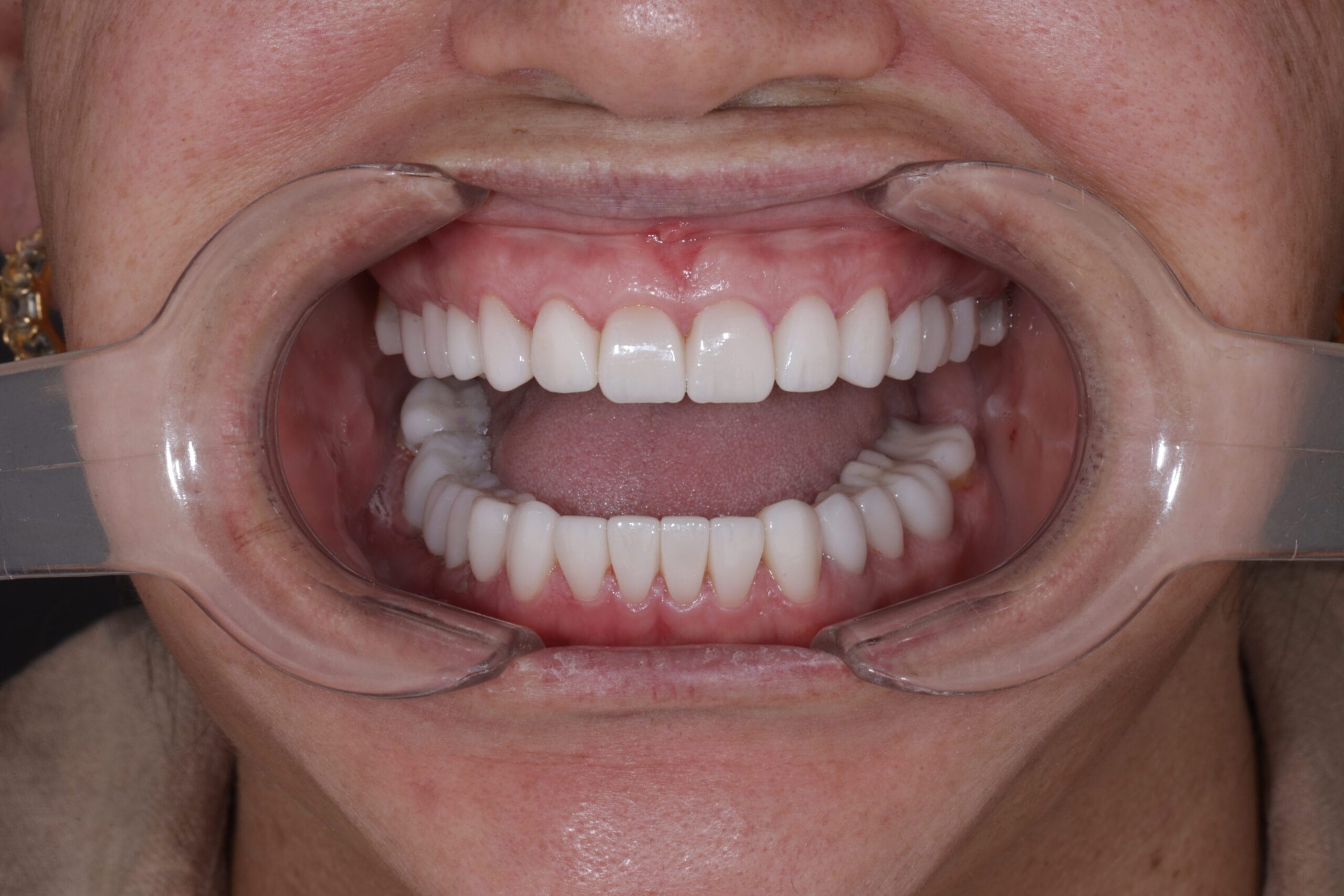 cosmetic dentist Barranquilla Dr. Daniel Zabaleta