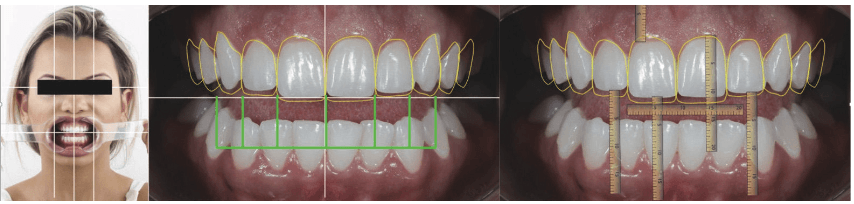 smile design face shape