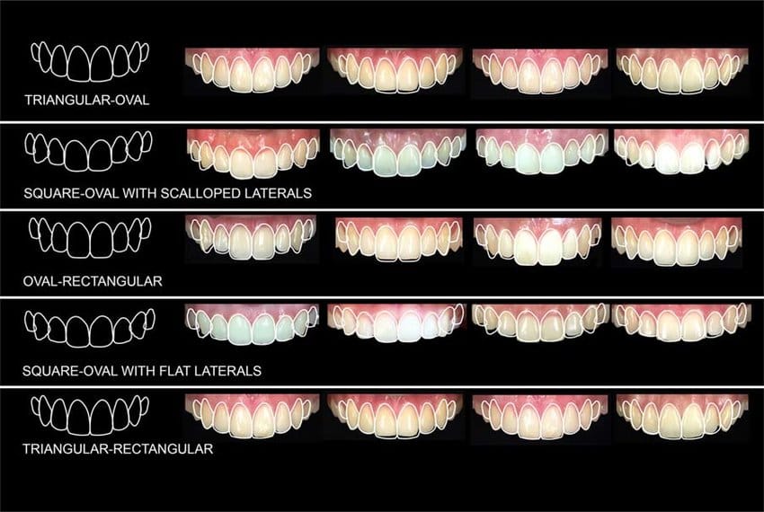 smile design face shape